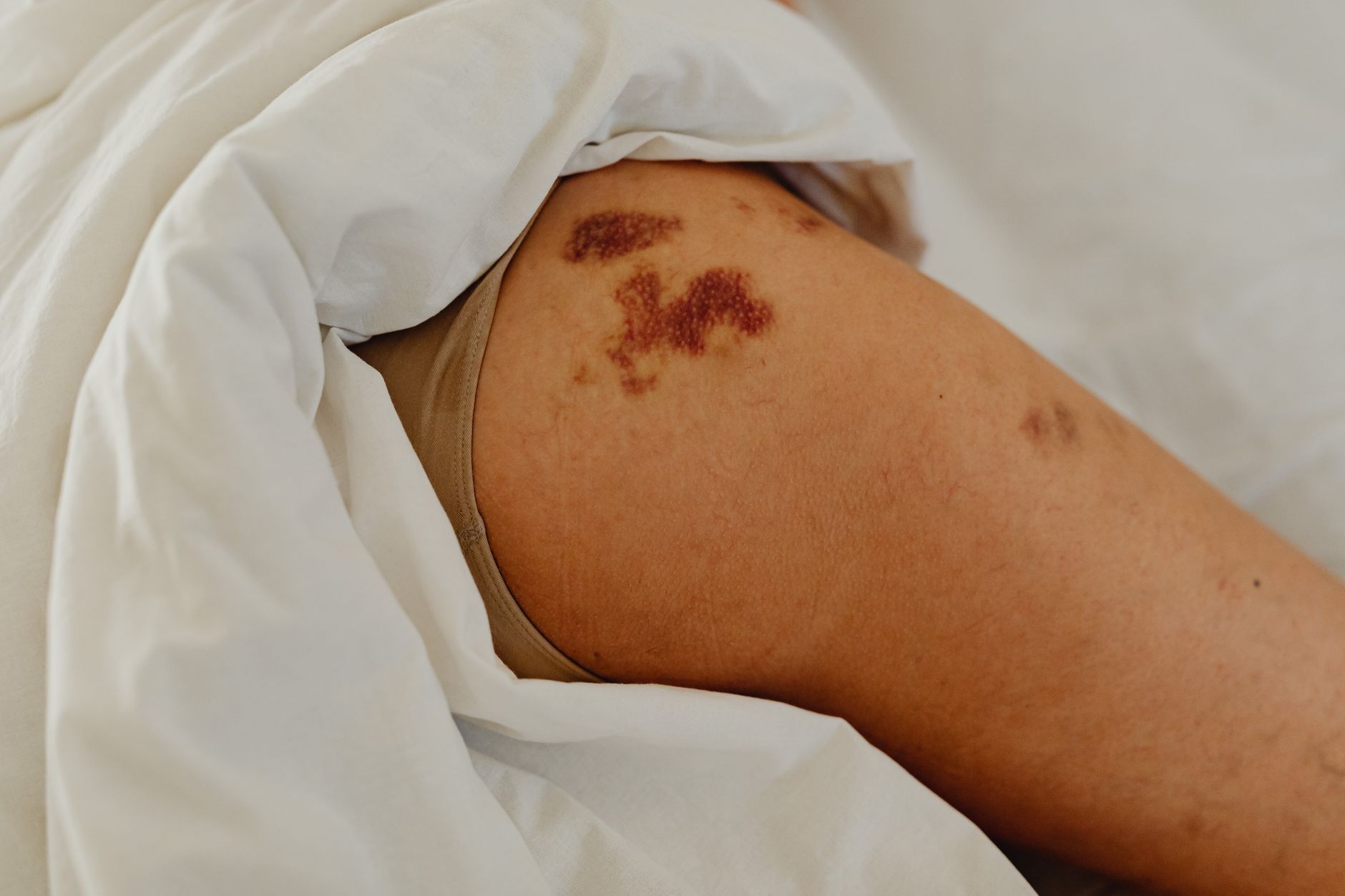 Cyclosporiasis-Infektionen - Erstmals Todesfälle durch grassierende Durchfallerkrankung in den USA