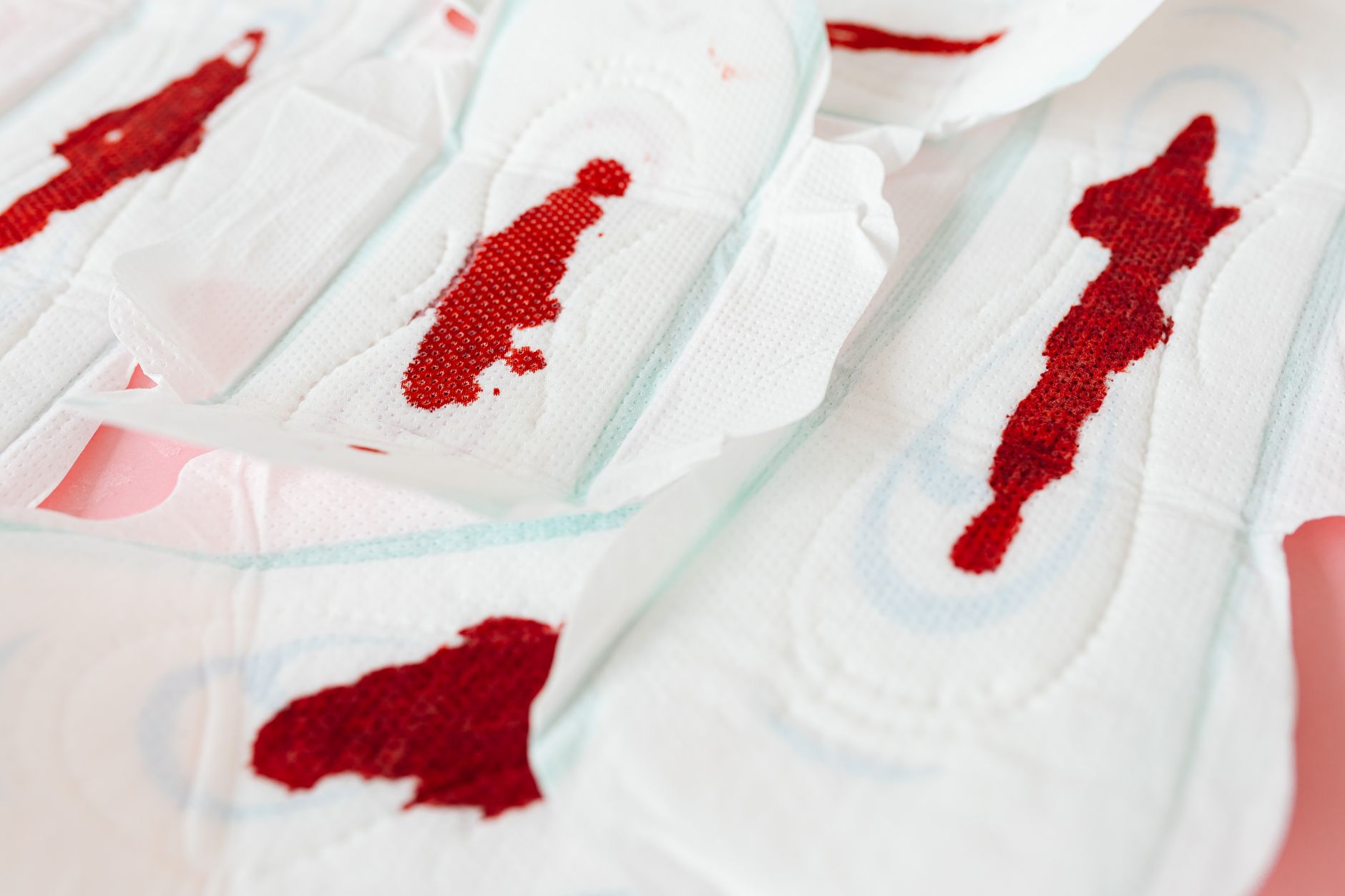 Welt-Sepsis-Tag: Warum bei Blutvergiftungen oft zu viel Zeit vergeht